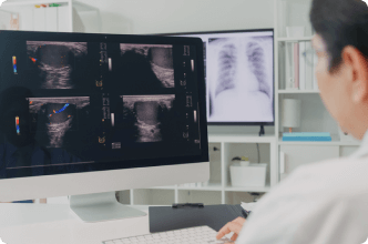 Cancer screening via imaging