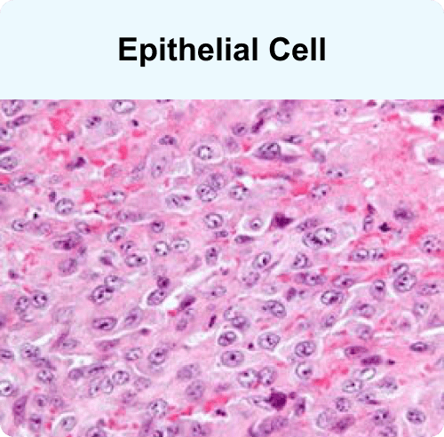 Epithelial Cell, a mesothelioma cell type